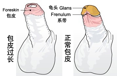 男性做包皮手术的费用是多少